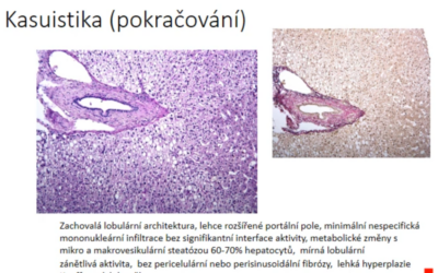 Celiakie a játra